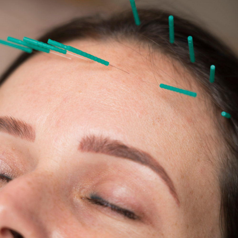 Acupuncture cosmétique holistique (cours)