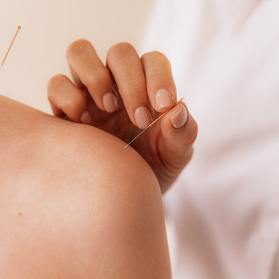 Dry Needling vs Acupuncture  White Lotus 