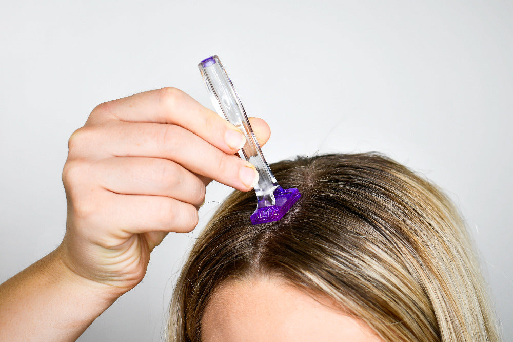 A dermastamp being used on a scalp for hair restoration