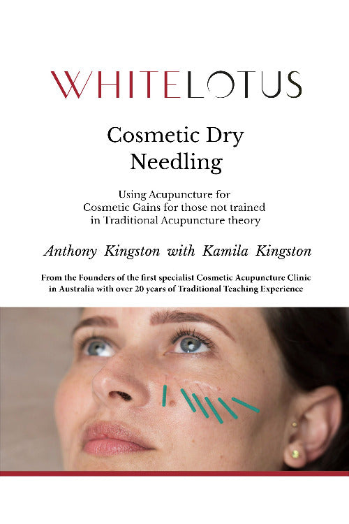 Book cover of 'White Lotus Cosmetic Dry Needling' with a woman's face showing acupuncture lines.